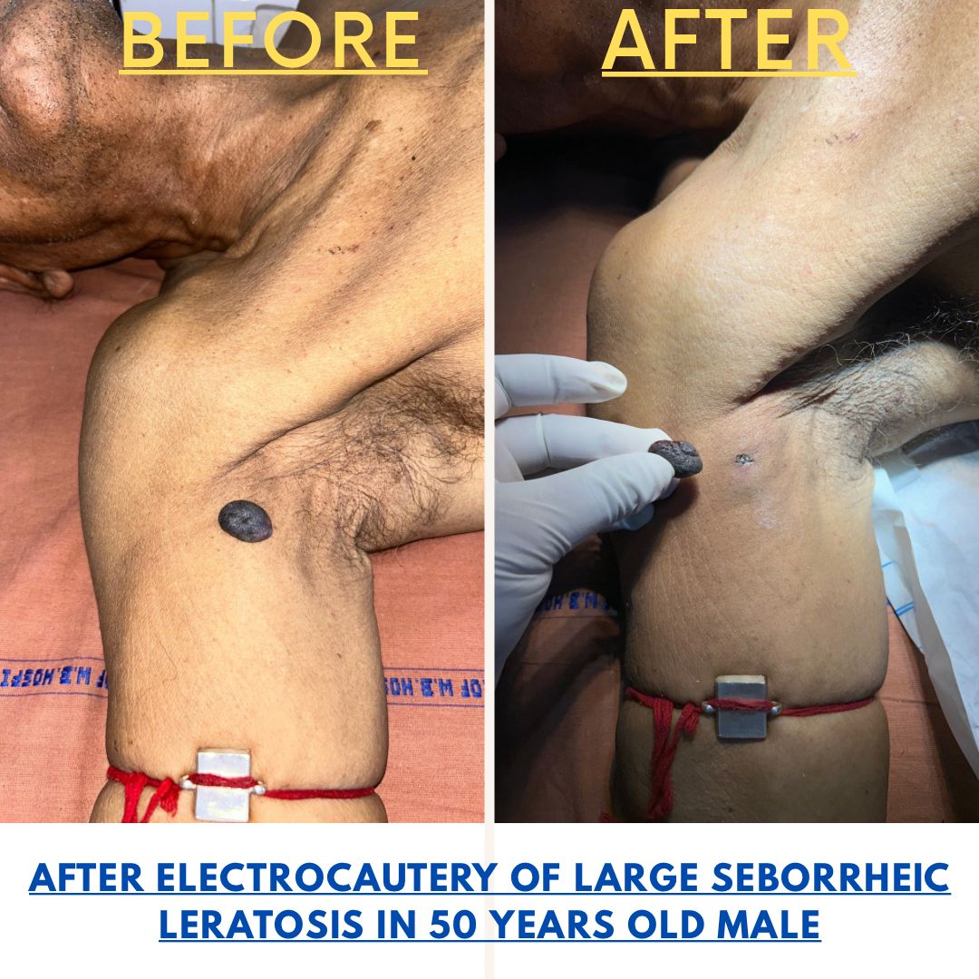 Before and After Treatment - Case 1